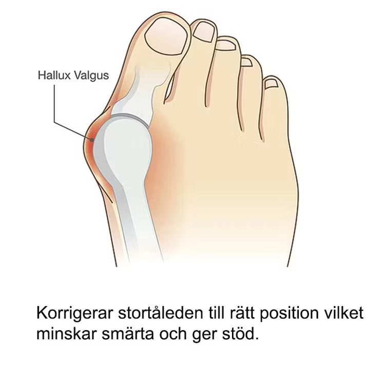 Hallux valgus silikonskydd