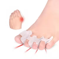 Hallux valgus tåspridare (stort avstånd, 2st)