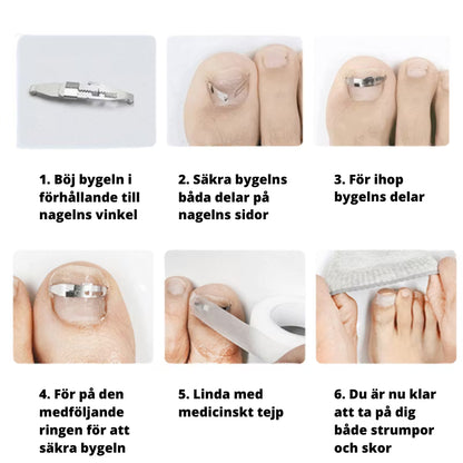 Nageltrång (bygel)
