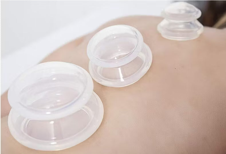 Cupping - Massage Kit