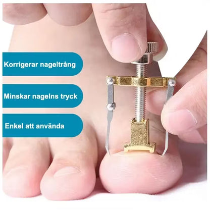 Nageltrång (skruv)