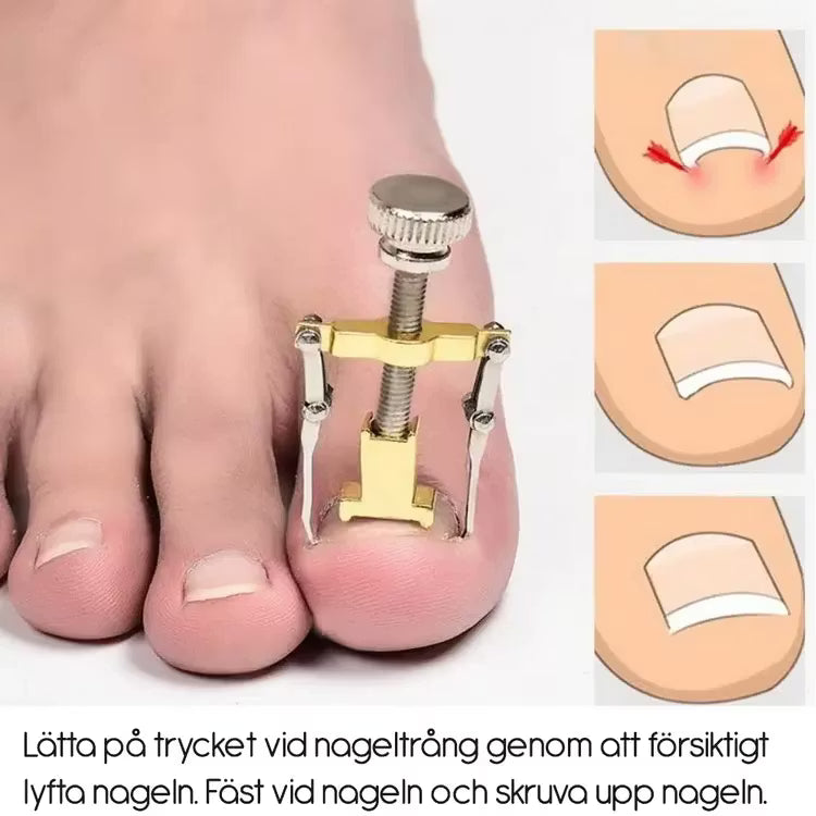 Nageltrång (skruv)