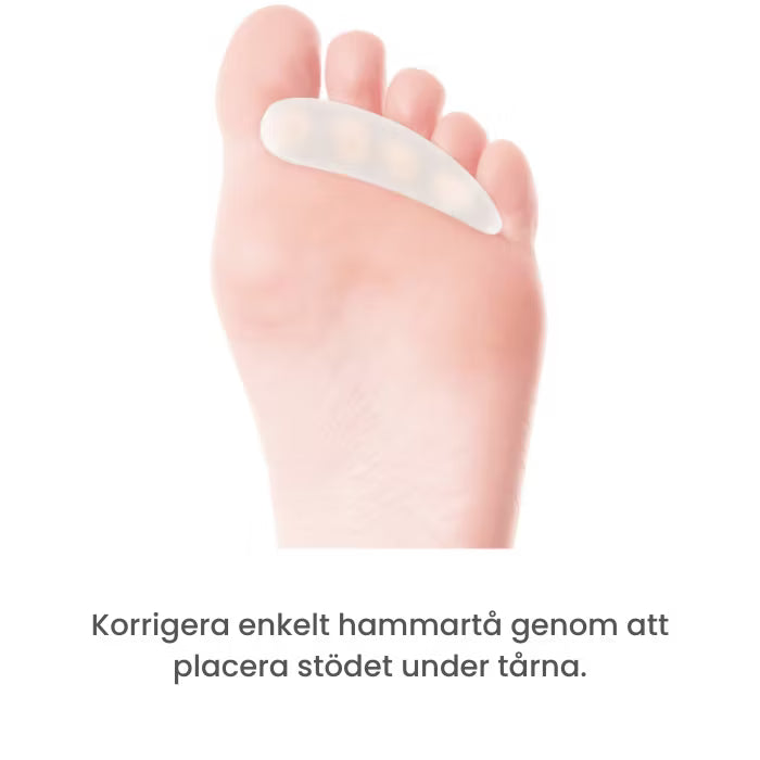 Hammartå (2 st stöd)