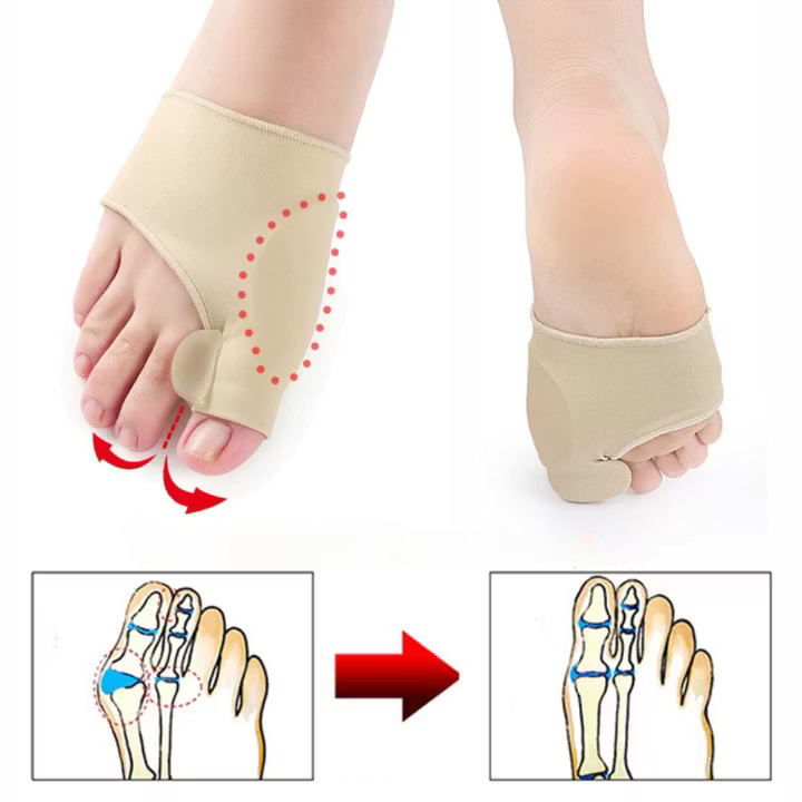 Hallux Valgus Korrigerare